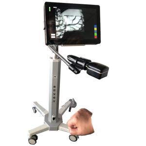 China Medical Portable Vein Locator Device Spider Vein Removal Machine Imaging Depth < 10mm on sale