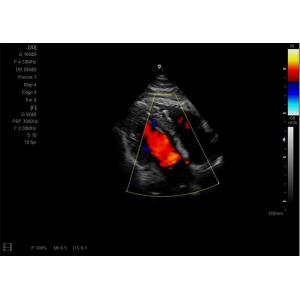 4d Ultrasound Machine Portable Ultrasound Scanner With 3D And Phased Array Probe