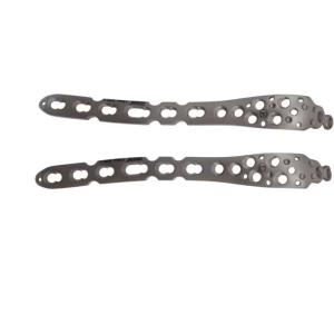 China 2.5mm Osteotomies Olecranon Plate Stainless Steel Olecranon Locking Plate wholesale