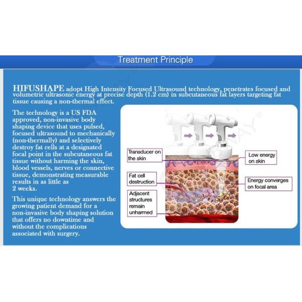 2016 new technology liposonix hifu body slimming shaping beauty equipment