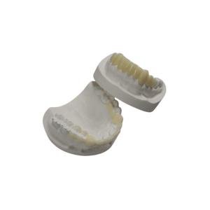 China Custom TEMP Porcelain Tooth Crown Inlay Onlay Strong Hardness Veneer wholesale