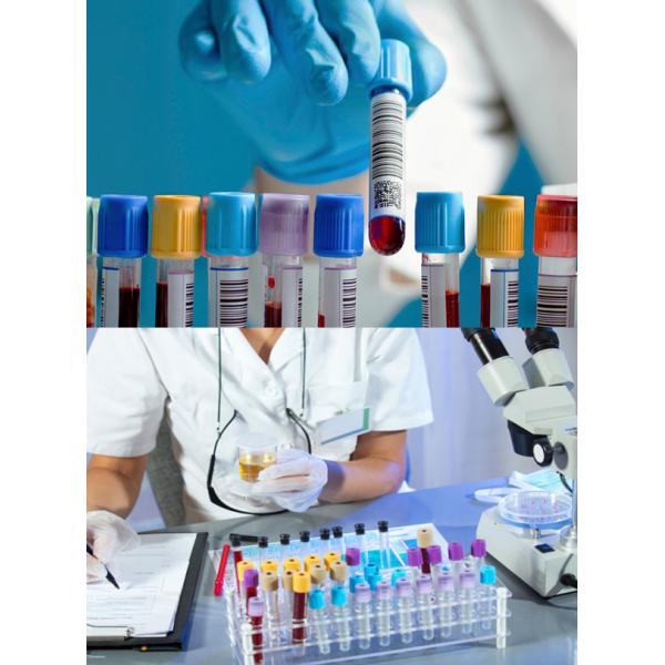 Medical Plastic Blue Green gray Plasma Blood Collection Tube Disposable Plasma Tube