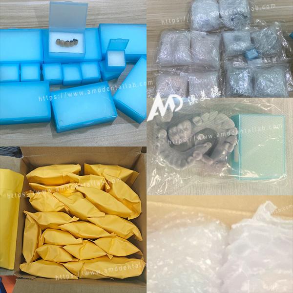 PMMA Hollow Temporary Bridges for Implant Provisional Cases