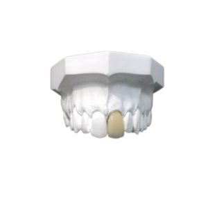 China Good Biocompatibility Porcelain Dental Crown High Tech Biological Material wholesale