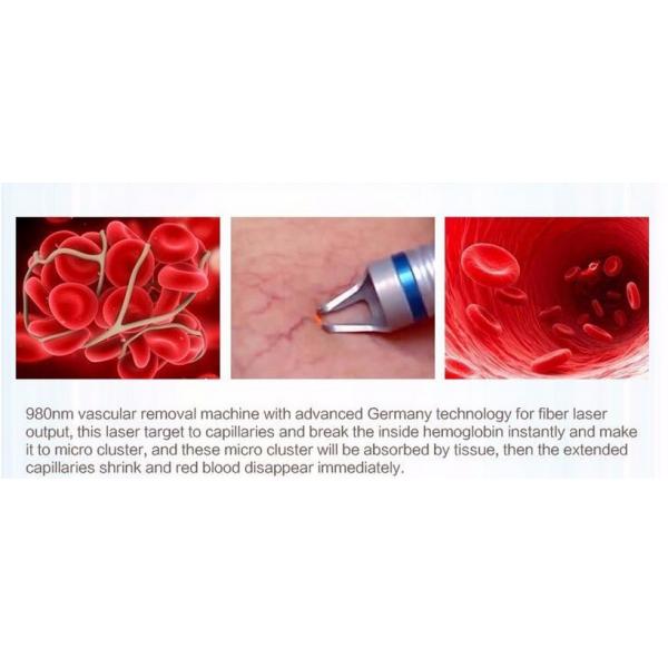 face vascular redness removal machine 15W 980nm Diode Laser Vascular Removal