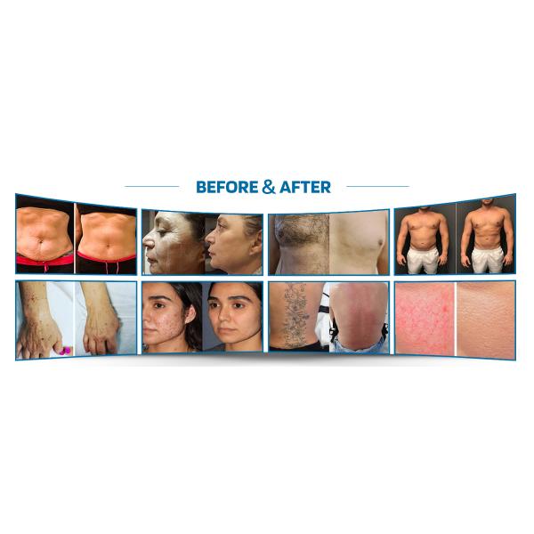 GMS Non-Invasive Magnetic and Infrared Therapy Device