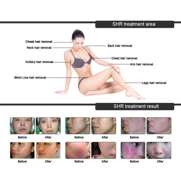 USB IPL Hair Reduction Machine , Intense Pulsed Light Hair Removal Machine OEM / ODM