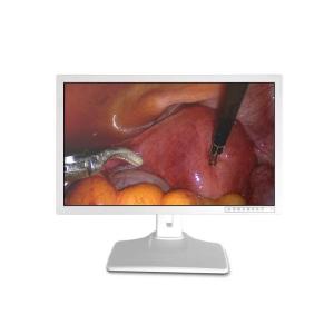 China HDMI VGA Medical Display 32 Inch 4k Monitor on sale