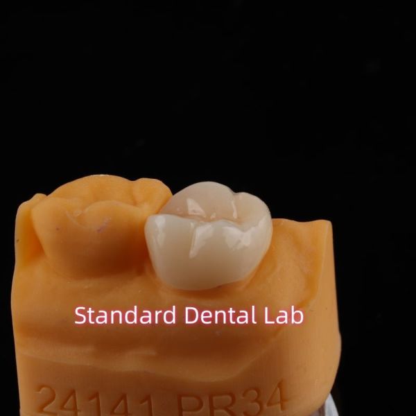 5-Year Guarantee Full Contour Zirconia Crown for Molar Teeth Noritake Porcelain Made in by Trusted Dental Laboratory