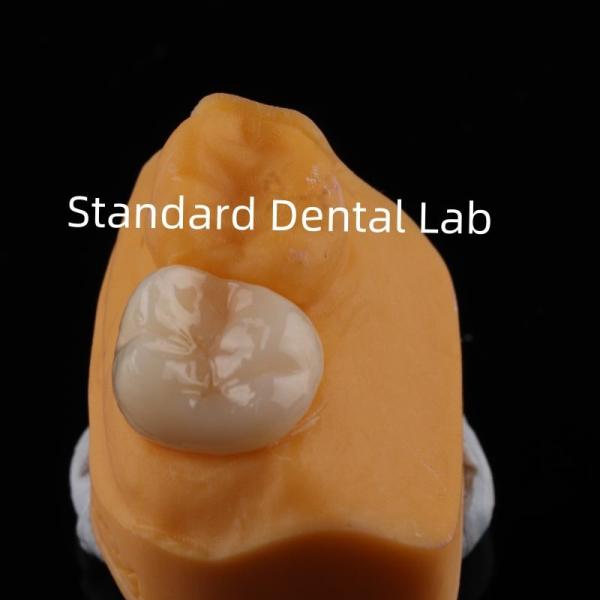 5-Year Guarantee Full Contour Zirconia Crown for Molar Teeth Noritake Porcelain Made in by Trusted Dental Laboratory