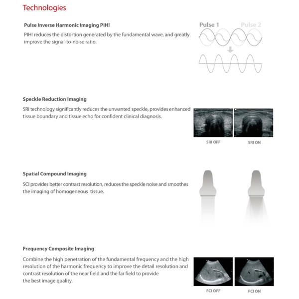 Portable 4D Ultrasound Machine Medical Data Interface Video VGA DICOM3.0 USB Printer Port