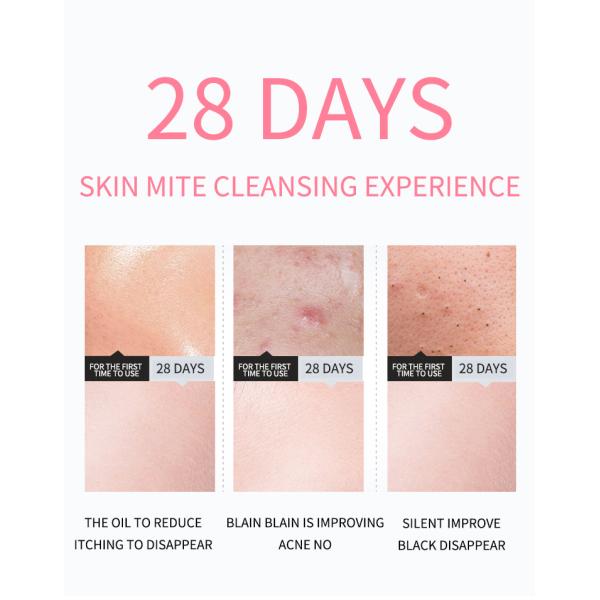 OEM Skincare 120ml Foaming Facial Cleanser Blackhead Remover Face Wash