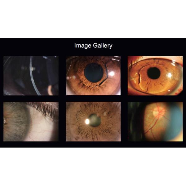 factory price led slit lamp microscope/slit lamp digital/digital portable slit lamp