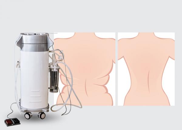 Quality Low Noise Body Shaped Power Assisted Liposuction Equipment For Hospital for sale