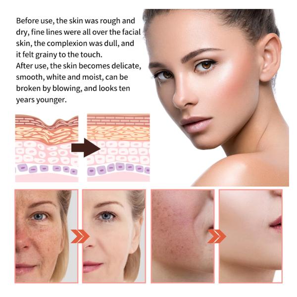 5 In 1 Skin Care Serum Dark Spot Whitening Serum Vitamin C Facial Serum