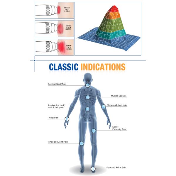 New Extracorporeal Shock Wave Therapy Device /Shockwave Machine Portable
