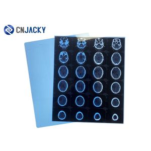 China Medical Dry Thermal Printer 36m Scanning X Ray Film wholesale