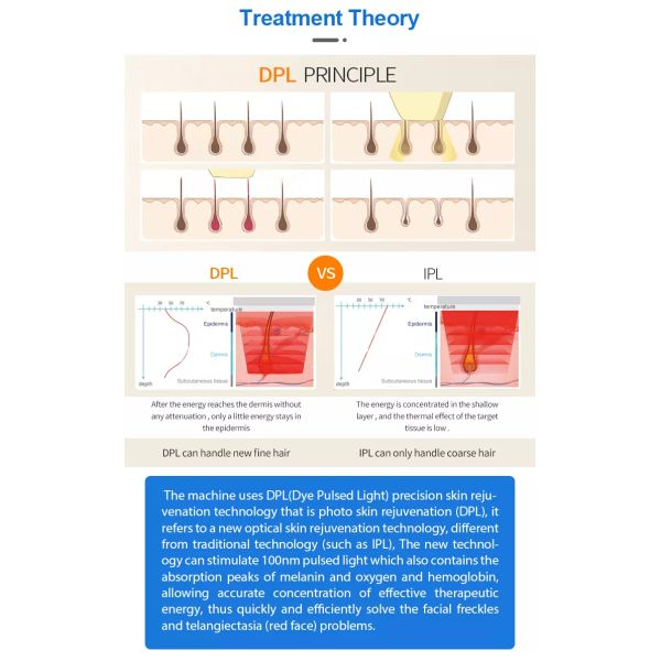 Best Selling OPT Lasers DPL Laser Beauty Machine for Skin Brightening Tender & Vascular Treatment &Hair Removal