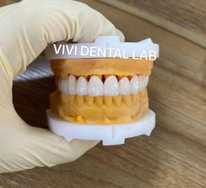 China CE Dental Tooth Crowns Nickel Beryllium Free VIVI Dental Laboratory wholesale