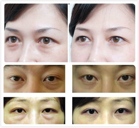 HOTTEST!! 5 IN 1 Potable Vacuum RF Home Cavitation Machine