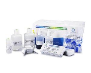 China 40 Tests / Kit SCD Method Sperm DNA Fragmentation Test Kit Wright Staining Dye wholesale