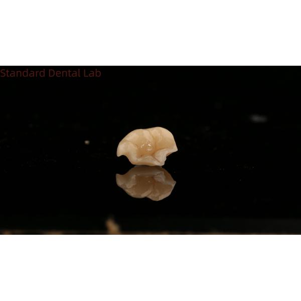 Strength Emax Ceramic Crown Dental Onlay with Excellent Stain Resistance China Dental Lab