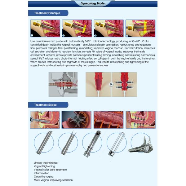 2016 laser equipment vaginal rejuvenation skin rejuvenation medical surgical 10600nm fractional co2 laser system machine