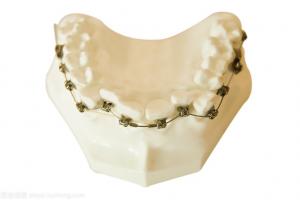 China Dental Brackets Orthodontics Fixed Tooth Modeling Tools Dental Braces wholesale