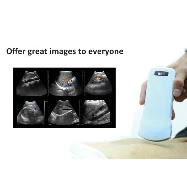 GH G10CT Medical Hospital Equipments 128 Element Wifi Ultrasound Probe Medical X Ray