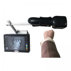 China Portable Economical Infrared Vein Finder Detecting About 10mm Depth of Vein Trolley Available wholesale