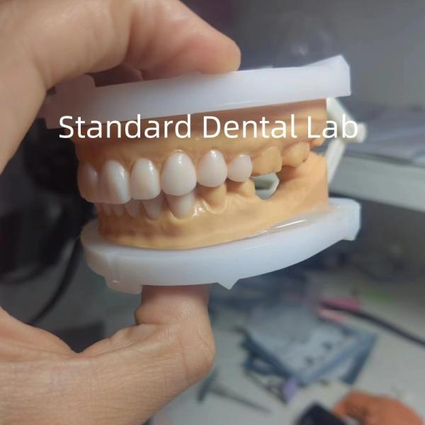 Perfect Esthetics Provisional Wax Up for Dental Professionals using dental wax from China Dental Lab