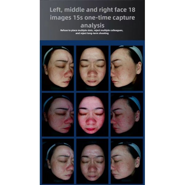 21.5 Inch 3 Cameras Hair Follicles Scalp Scanner Detector Facial Skin Analyzer Machine