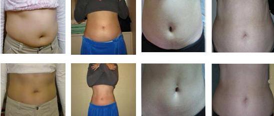 China Top Ten Selling Porducts! 2019 Hot Sale Body Slimming Mutifunction Cryolipolysis cavitation rf slim machine