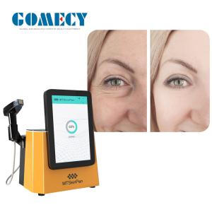 China 2 PCS Nano-L RF Heads Microneedle RF Device for Effective Face Lifting and Wrinkle Reduction Beauty Treatment wholesale