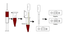 One Step TB Rapid Test Kit High Accuracy Immuno - Chromatography Technique
