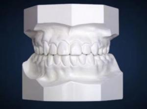 China Dental Ortho Study Model Ekodent For Orthodontic Treatment on sale