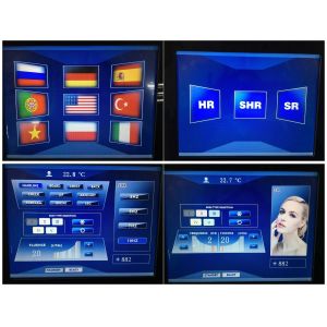 755+810+1064nm diode laser for hair removal