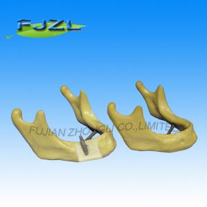 China dental implant manufacturers supply dental drill model on sale