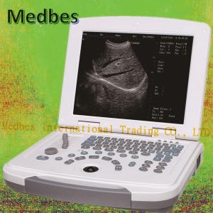 China Professional Ultrasound Imaging System 15 Inch LED Laptop Hospital Machine on sale