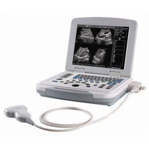 China B/W laptop ultrasound machine wholesale