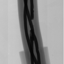 Simple and easy-to use automated inspection equipment——Ray X-6000