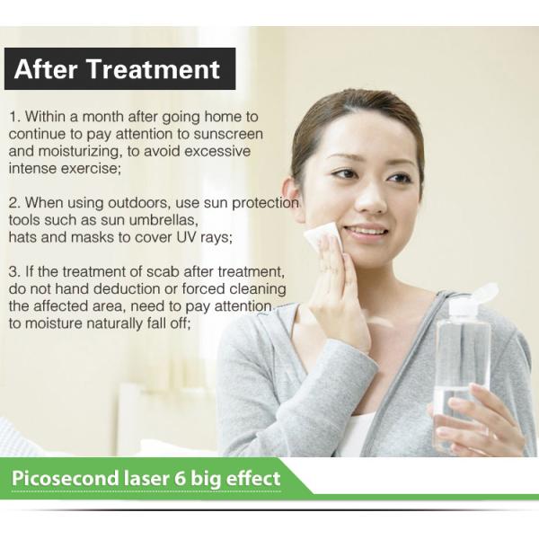 Dual Wavelength Picosecond Laser Tattoo Removal Machine 1064nm 532nm