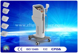 China High Intensity Focused Ultrasound HIFU Device Removal Double Chins wholesale