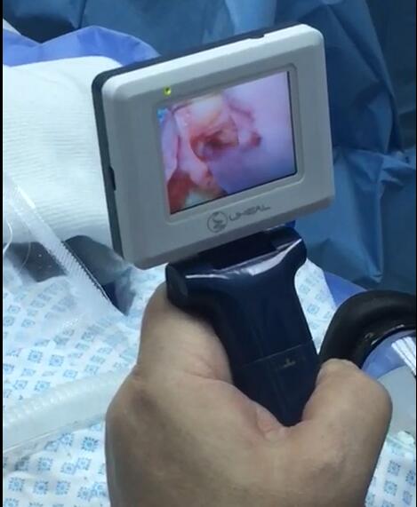 Mac 2 Pediatric Laryngoscope Blade Size For Children Kid Airway Intubation