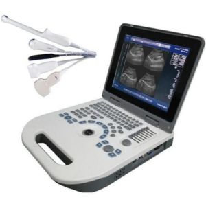 China OEM OB Obstetric Ultrasound Equipment LCD Display TGC Control wholesale