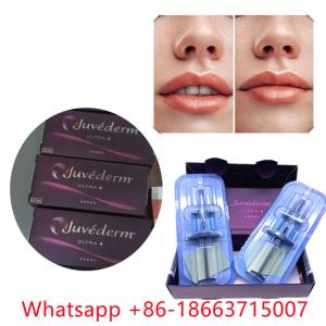 China Juvederm Ultra 4 (2x1ml) Injectable Dermal Filler Lip Enlargement wholesale