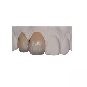 China Body Strength Thin Zirconia Crown Durable Natural Realistic Restoration wholesale