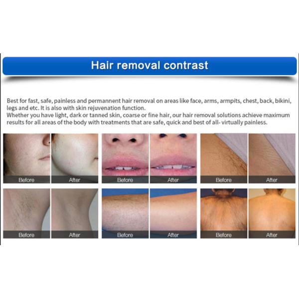 Painless Diode Laser Hair Removal Machine Q Switched Nd Yag Laser 1064 Nm