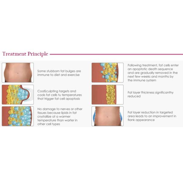 2016 professional fat reduce slimming equipment cryo fat freeze machine with 2 years warranty