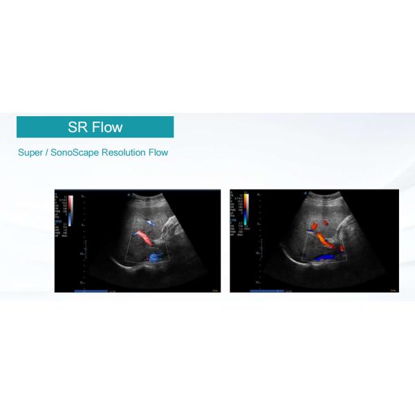 Doppler Color Ultrasonic Ultrasonido Portatil SonoScape E2
